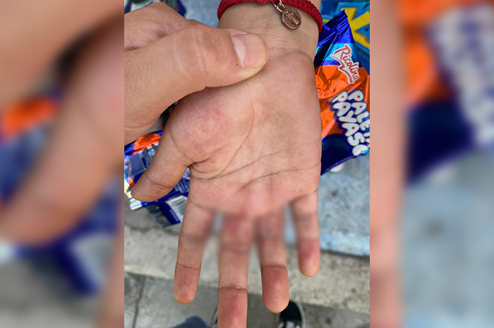 niña maltratada padrastro reyes la paz