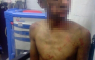 Explota polvorín en Texcoco; dos menores heridos
