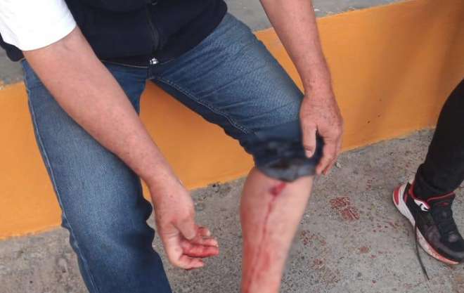 Balacera en cocina económica de #Edomex deja muertos y heridos