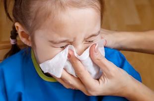 El virus sincital es una enfermedad viral considerada como común y que causa síntomas leves similares al resfriado.
