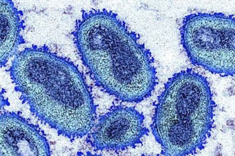 La OMS identificó enfermedades contagiosas prioritarias, que probablemente causarán la próxima pandemia.