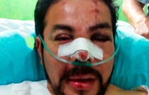 Atacan al precandidato de Morena a la alcaldía de Coacalco; está en el hospital