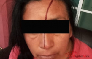 #Toluca: golpean a dos mujeres en San Pablo Autopan