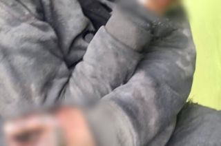 Se quema tragafuego en Toluca