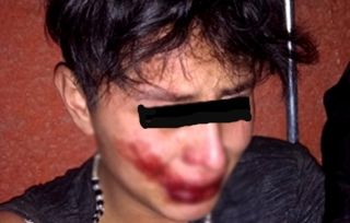 Ladrón es brutalmente golpeado por vecinos del Seminario en Toluca