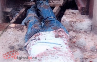 Otro ataque de perros; hombre se salva de morir en Toluca